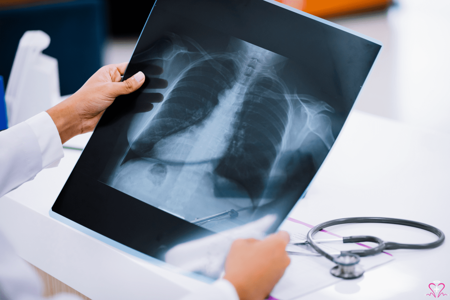 The Importance of X-Ray Services - Doctor examining a chest X-ray film