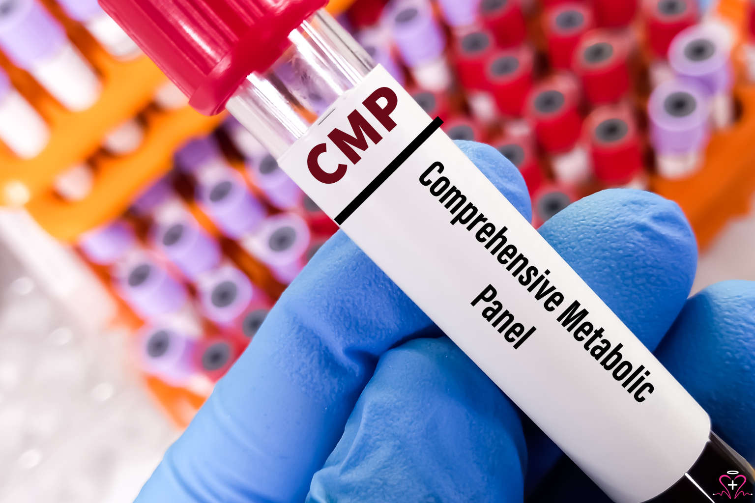 How to Interpret a Comprehensive Metabolic Panel - Gloved hand holding a test tube labeled Comprehensive Metabolic Panel (CMP)