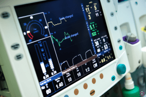 Close-up of a medical ventilator display showing detailed respiratory data.