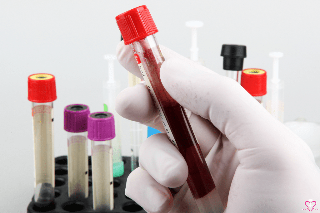 Men's Health Blood Tests - A close-up image of a gloved hand holding a blood sample vial with a red cap. In the background, several other vials with different colored caps are placed in a rack.