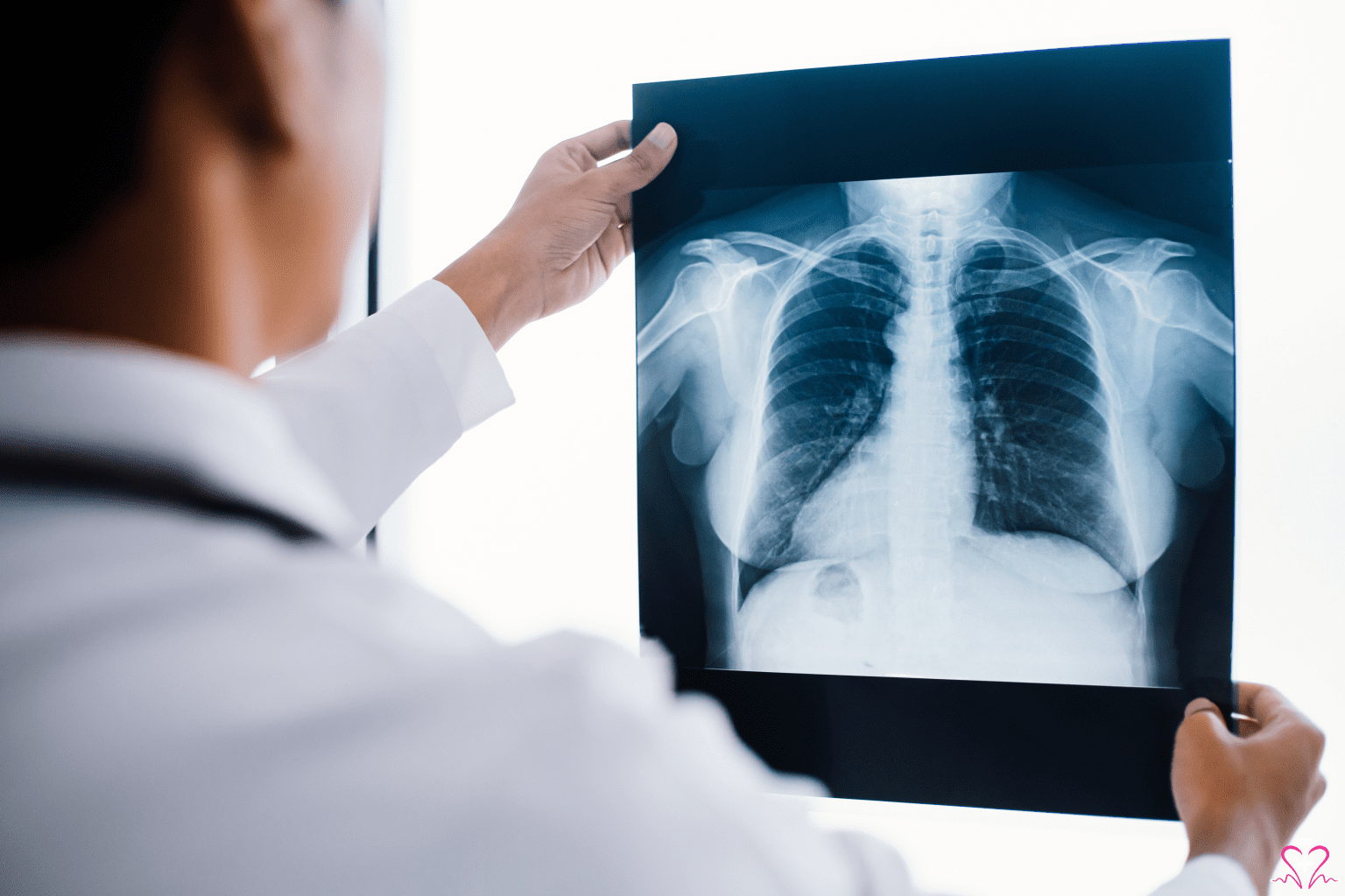 X-Ray Services - A medical professional examining a chest X-ray film held up to a lightbox.