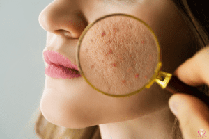 Common Skin Conditions: A Dermatology Guide