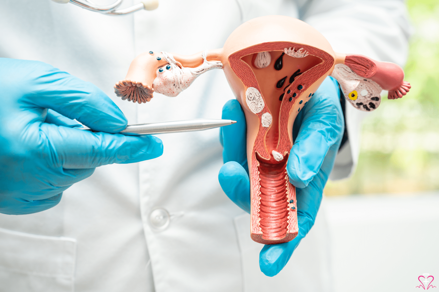 Gynecologists: When to Visit and What to Expect - Doctor holding a model of the female reproductive system and pointing with a pen.