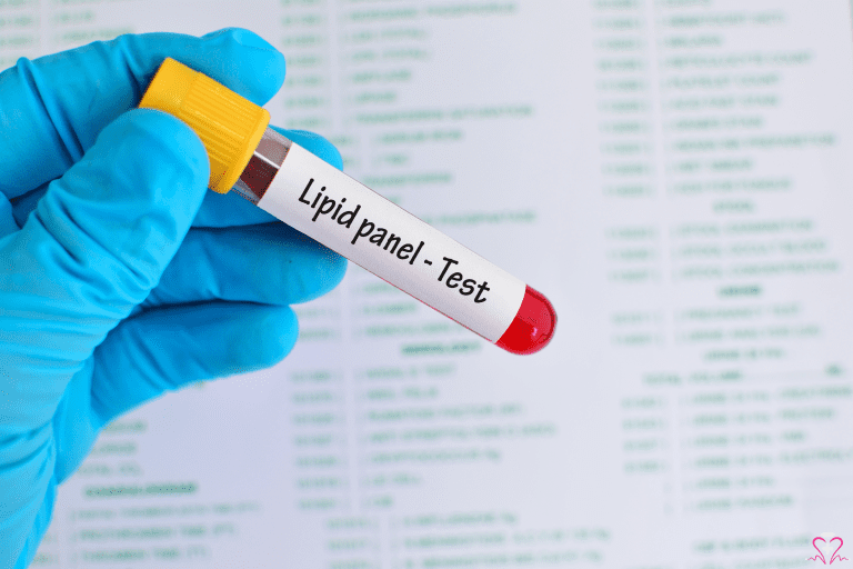 Tips for Improving Your Lipid Panel - Gloved hand holding a test tube labeled Lipid panel - Test