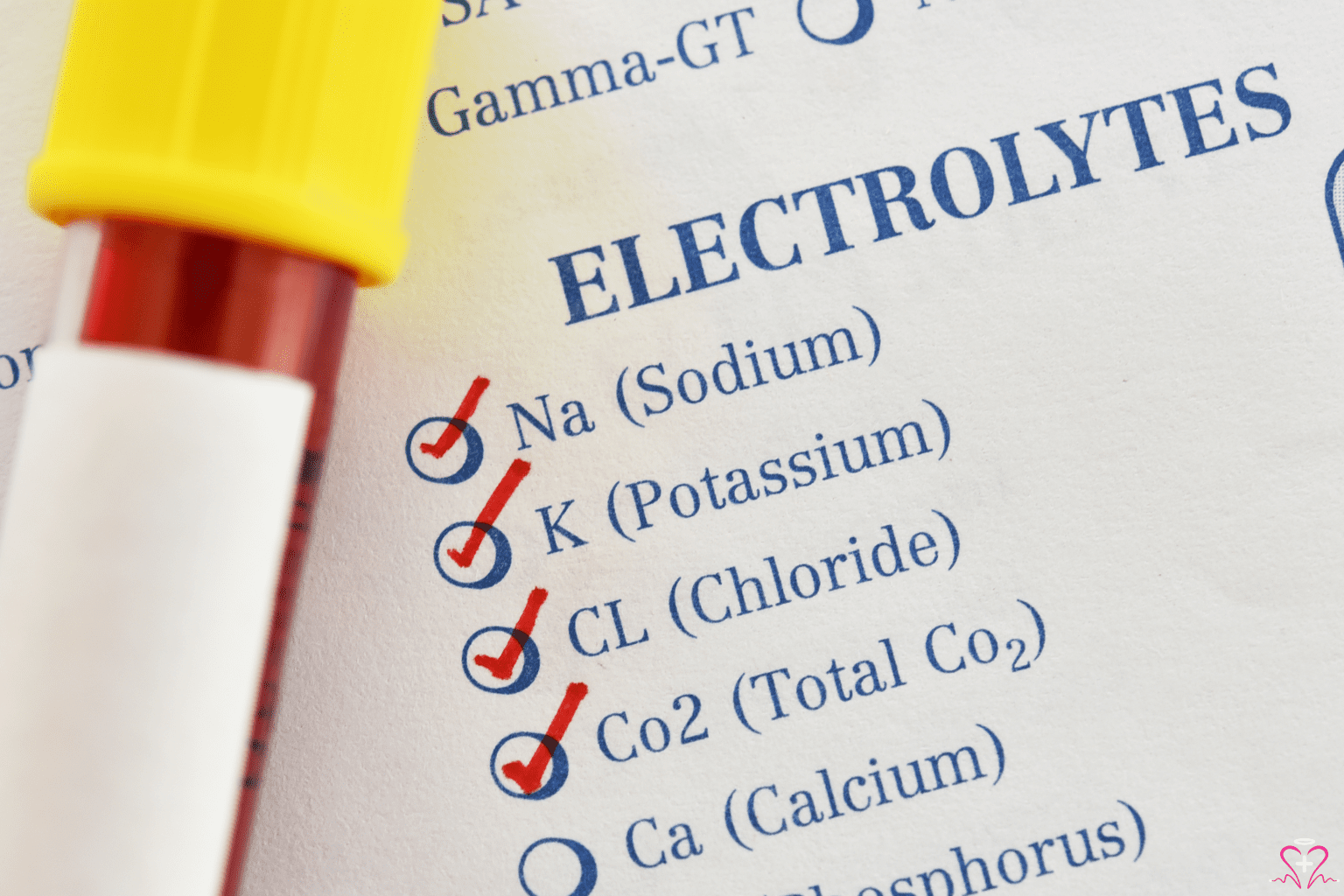 Common Electrolyte Panel Abnormalities Explained - Test tube and a checklist of electrolyte levels including sodium, potassium, chloride, and CO2