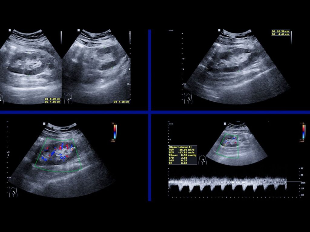 Abdominal & Renal Ultrasound