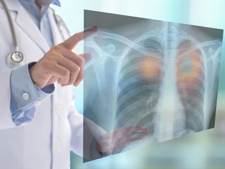 Doctor reviewing a mobile chest X-ray image on a transparent screen, representing professional mobile X-ray services for seniors.