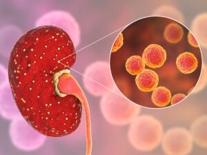 Learn about Urinary Tract Infection testing and its importance for seniors at increased risk for complications from UTIs.