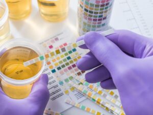 Explore our urine drug testing services for accurate drug presence identification in patients. Enhance safety and healthcare decisions.