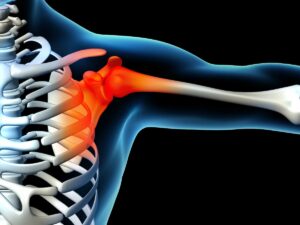 3D medical illustration of shoulder joint anatomy showing inflammation used for musculoskeletal ultrasound education for seniors.