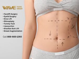 Wave Plastic Surgery