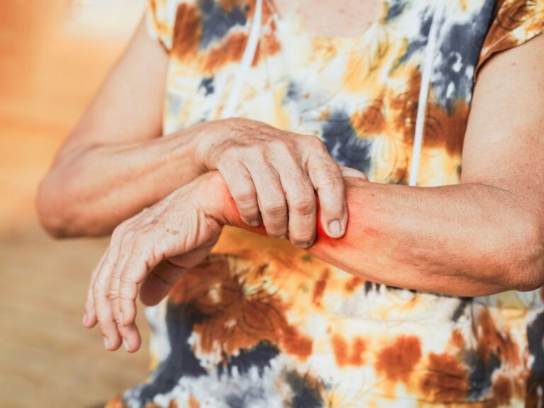 Senior woman massaging her wrist due to joint pain – wrist pain treatment and arthritis care for seniors in Los Angeles.