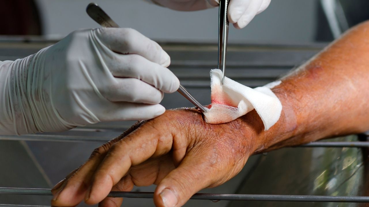 Nurse cleaning a senior’s arm wound with sterile gauze, representing proper home wound care for seniors.