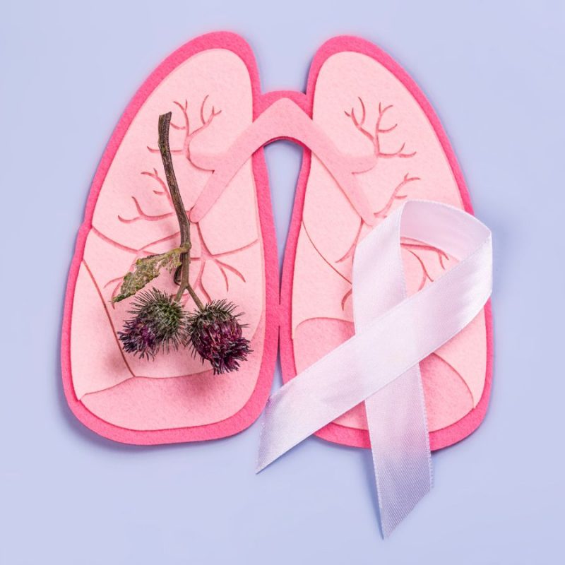 Lung Cancer
